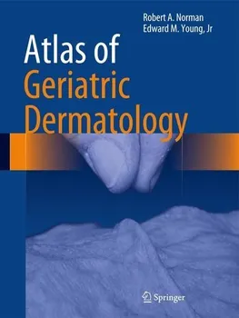 Atlas of Geriatric Dermatology - Robert A. Norman, Edward M. Young [EN] (2013, pevná)