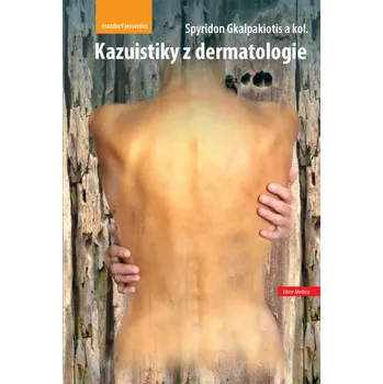 Kazuistiky z dermatologie - Spyridon Gkalpakiotis