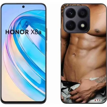 Pouzdro na mobilní telefon Gelový kryt mmCase na mobil Honor X8a - sexy muž