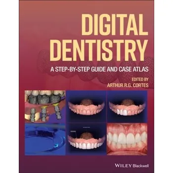 Digital Dentistry: A Step-by-Step Guide and Case A tlas - Cortes, ARG