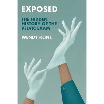 Exposed - Kline, Wendy