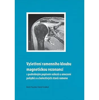 Kniha Vyšetření ramenního kloubu magnetickou rezonancí s podrobným popisem nálezů u omezení pohybů u boles Ekniha