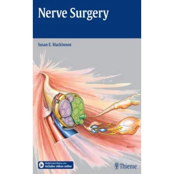 Nerve Surgery – Susan E. MacKinnon (EN)
