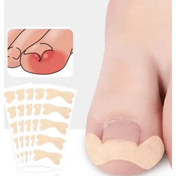 Přípravek na nehty Korektor na zarostlé nehty - nálepky pro péči o nohy