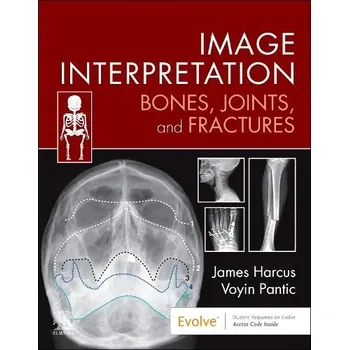 Cizojazyčná kniha Image Interpretation: Bones, Joints, and Fractures - Harcus, James (Lecturer in Diagnostic Imaging, University of Leeds, UK) a Pantic, Voyin