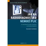 Jak na radiodiagnostiku nemocí plic -…