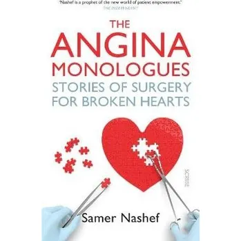 Cizojazyčná kniha Angina Monologues - Nashef, Samer