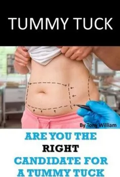 učebnice Tummy Tuck: Are You The Right Candidate For A Tummy Tuck - Tony William [EN] (2017, brožovaná)