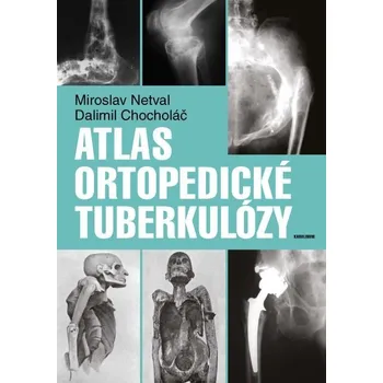 Kniha Atlas ortopedické tuberkulózy - Dalimil Chocholáč, Miroslav Netval (E-Kniha)