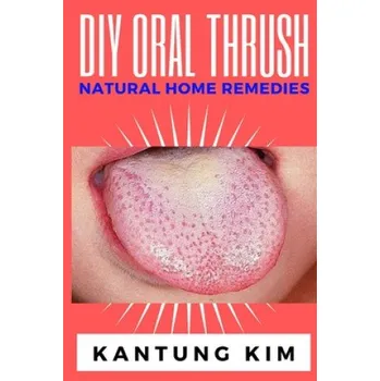 Cizojazyčná kniha DIY Oral Thrush Natural Home Remedies: The Effective Step By Step Guide To Permanently End Oral Thrush – Kantung Kim (EN)