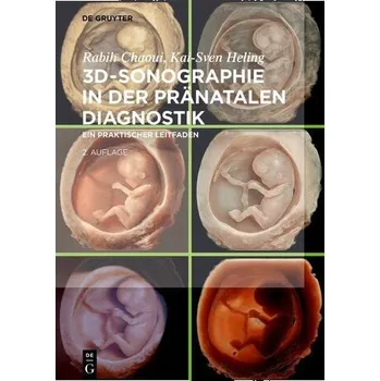 3D-Sonographie in der pränatalen Diagnostik - Chaoui, Rabih