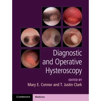 Diagnostic and Operative Hysteroscopy