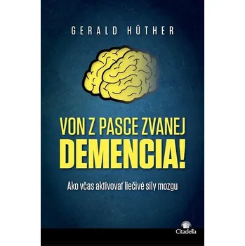 Von z pasce zvanej demencia! - Gerald Hüther (E-Kniha)