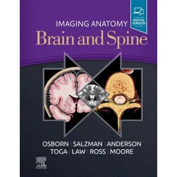Imaging Anatomy Brain and Spine – Karen L. Salzman,Jeffrey S. Anderson (EN)