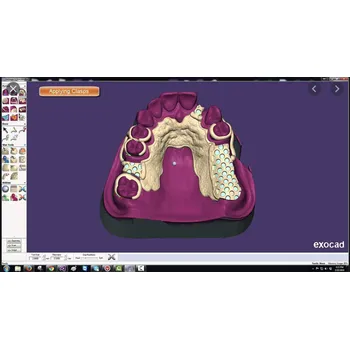 Grafický software Exocad - CAD software Modul: Parcial CAD