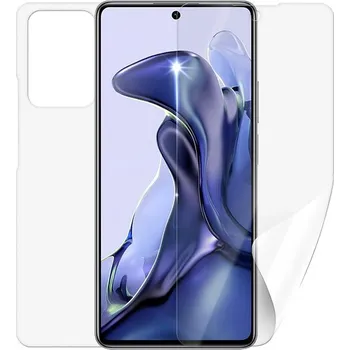 Screenshield XIAOMI 11T na celé tělo