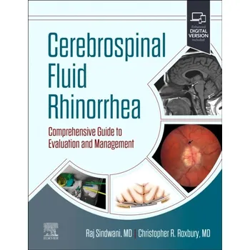Cerebrospinal Fluid Rhinorrhea, Comprehensive Guide to Evaluation and Management - Sindwani & Roxbury