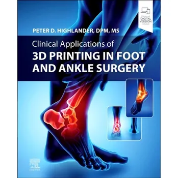 Clinical Applications of 3D Printing in Foot and Ankle Surgery - Highlander