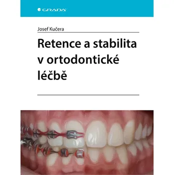 Retence a stabilita v ortodontické léčbě