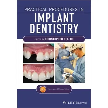 Kniha Practical Procedures in Implant Dentistry - CCK Historic with Daniel H. Lackey