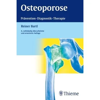 Osteoporose - Bartl, Reiner