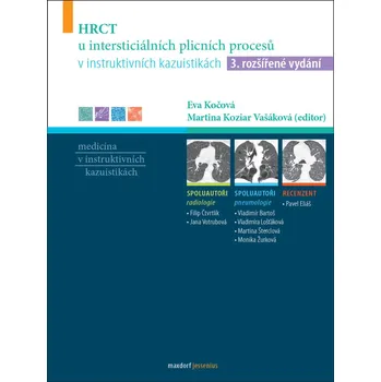 HRCT u intersticiálních plicních procesů v instruktivních kazuistikách - Eva Kočová, Martina Vašáková