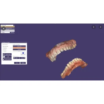Grafický software Exocad - CAD software Modul: Bite