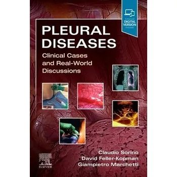 Cizojazyčná kniha Pleural Diseases