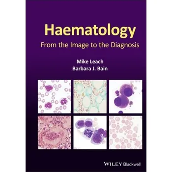 Haematology - Garley, Mike; Matthews, Alex; Scott, Cavan; Leach, David