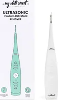 My White Secret Ultrasonic ultrazvukový čistič skvrn a zubního plaku