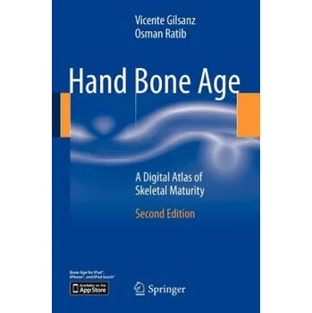 Umění Hand Bone Age – Osman Ratib (EN)