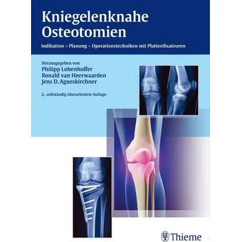 Kniegelenknahe Osteotomien - Lobenhoffer, Philipp