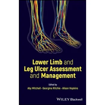 Učebnice Lower Limb and Leg Ulcer Assessment and Management