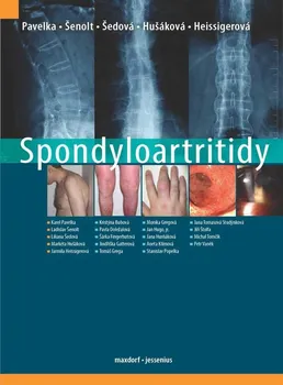 Spondyloartritidy - Karel Pavelka a kol. (2021, pevná)