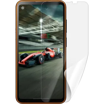 Screenshield ochranná fólie pro iGET Blackview GBL5000