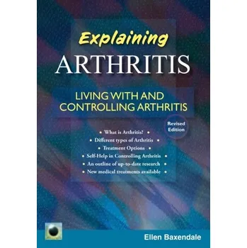An Emerald Guide To Explaining Arthritis - Baxendale, Ellen