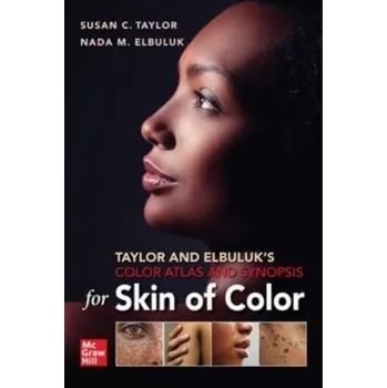 Učebnice Taylor and Elbuluk's Color Atlas and Synopsis for Skin of Color - Taylor Susan M.