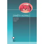Záněty hltanu - Pavel Komínek a kol.…