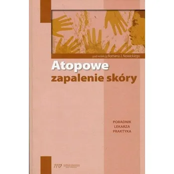 Atopowe zapalenie skóry. Poradnik lekarza praktyka - Praca zbiorowa