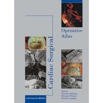 Cardiac Surgical Operative Atlas - Wahlers, Thorsten