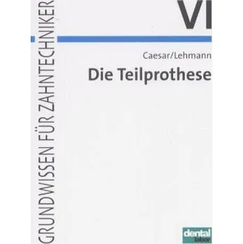 Die Teilprothese - Caesar, Hans H.