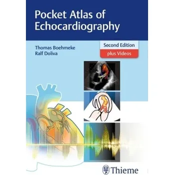 Pocket Atlas of Echocardiography - Böhmeke, Thomas
