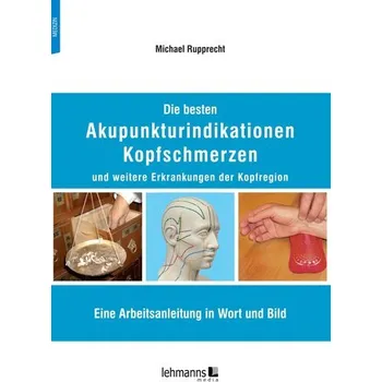 Die besten Akupunkturindikationen Kopfschmerzen und weitere Erkrankungen der Kopfregion - Hofbeck, Michael; Deeg, Karl-Heinz; Rupprecht, Thomas