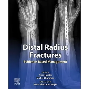 Cizojazyčná kniha Distal Radius Fractures