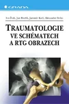 Traumatologie ve schématech a RTG…