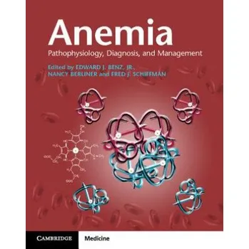 Anemia Paperback with Online Resource - Edward J Benz Jr. (anglicky, 2010, brožovaná)