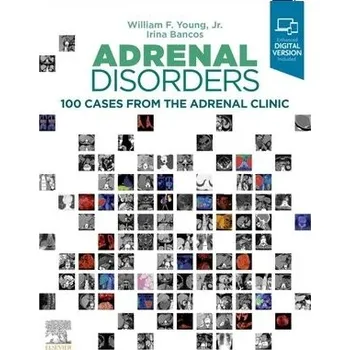 Cizojazyčná kniha Adrenal Disorders - Young, William F. (Division of Endocrinology, Diabetes, Metabolism, and Nutrition, Tyson Family Endocrinology Clinical Professor a Professor of Medicine, Mayo Clinic College of Medicine, Rochester, Minnesota, USA) a Bancos, Irina, MD (