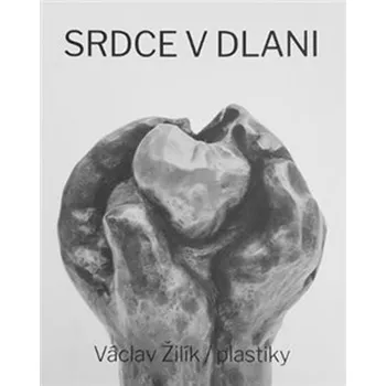 Srdce v dlani / Plastiky