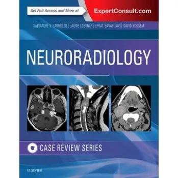 Neuroradiology Imaging Case Review – Loevner,Laurie A.,MD,Efrat Saraf-Lavi,David M. Yousem (EN)
