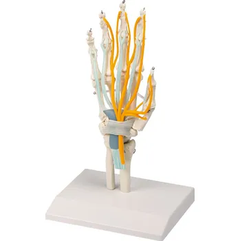 Ruka se šlachami, nervy a karpálním tunelem